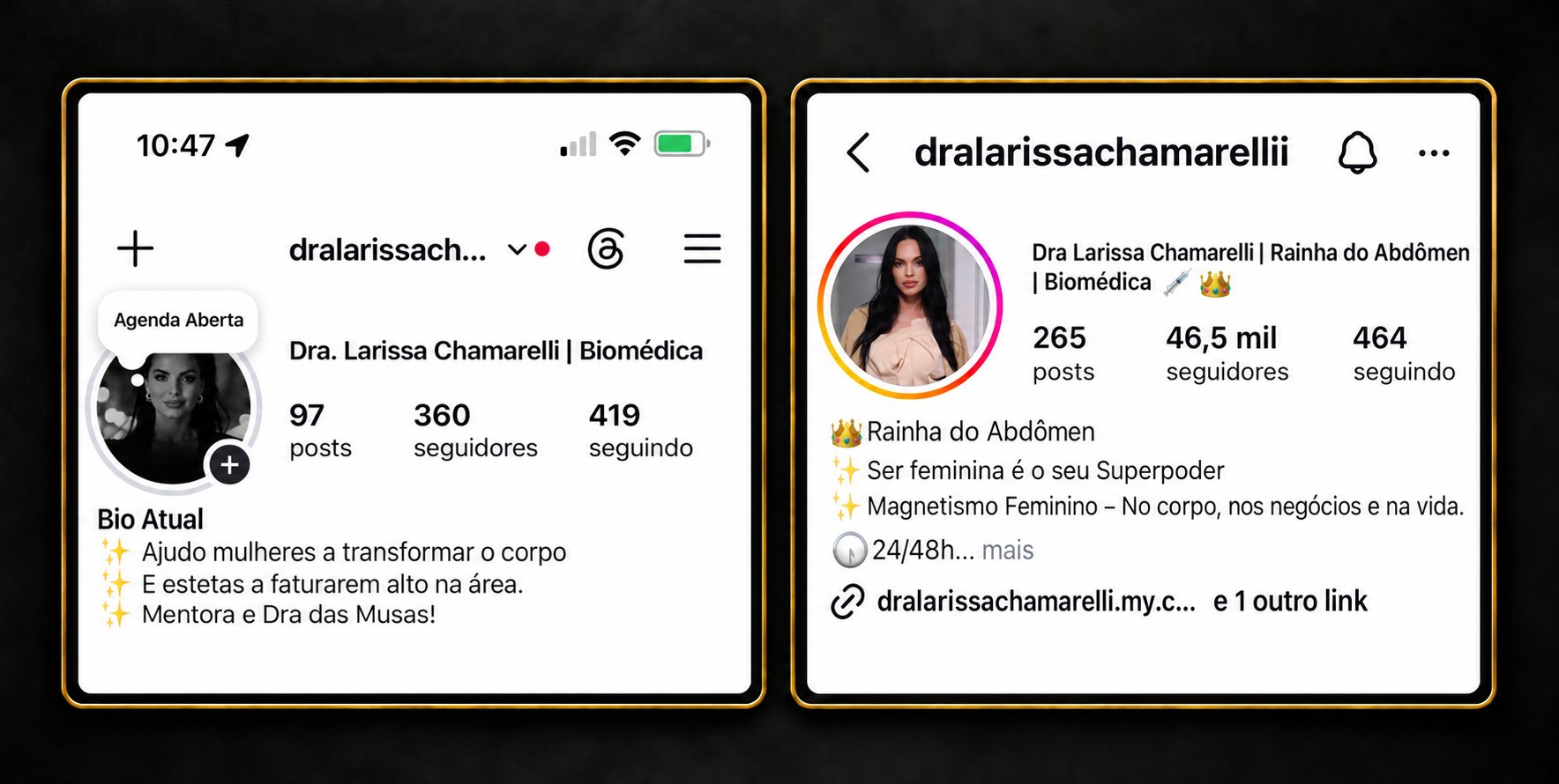 Print do perfil de Dra. Larissa Chamarelli antes e depois